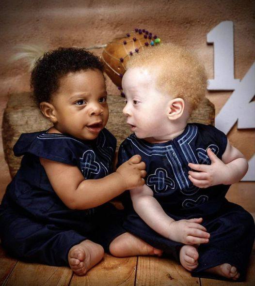 Mother gives birth to black and white twin boys – but neither parent is white