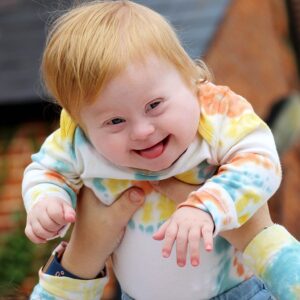 I Had to Face Challenges With My Entire Family Following the Birth of My Down Syndrome Baby